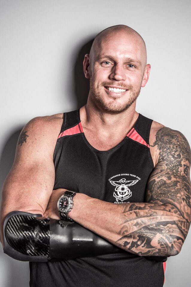 Smiling bald man with prosthetic arm and tattoos